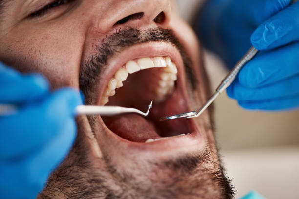 Best Emergency Denture Repair in Rockdale, TX